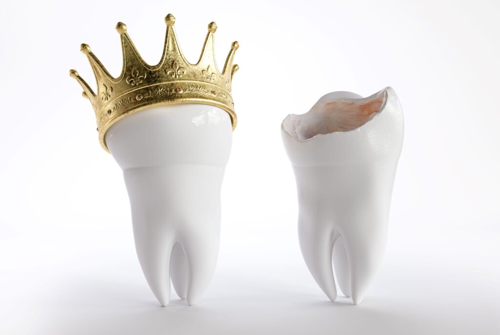 Fake tooth with a gold crown next to a damaged tooth with a white background