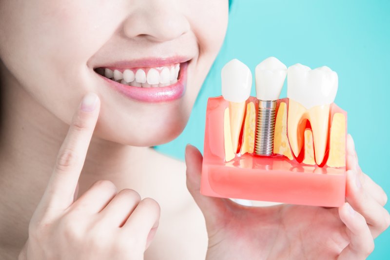 A woman holding up an enlarged dental implant model